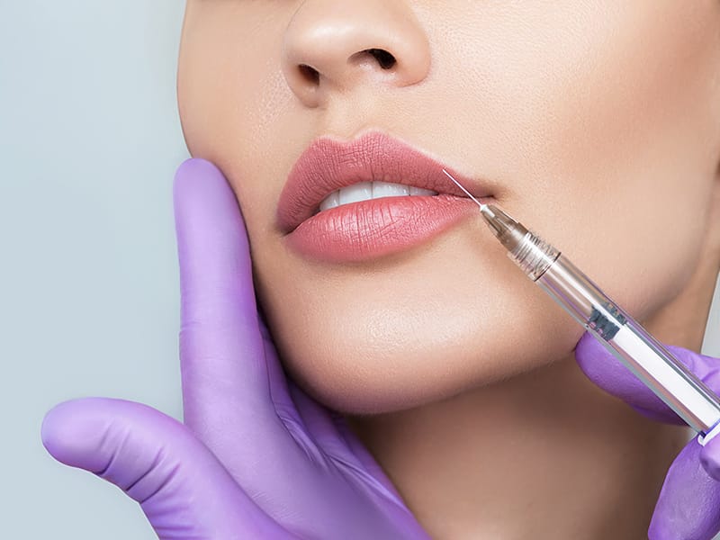 Dermal filler injections melbourne